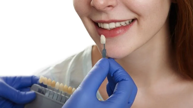 A1 tooth shade