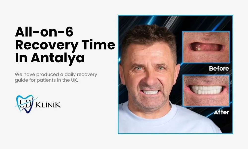 All-on-6 recovery time in Antalya