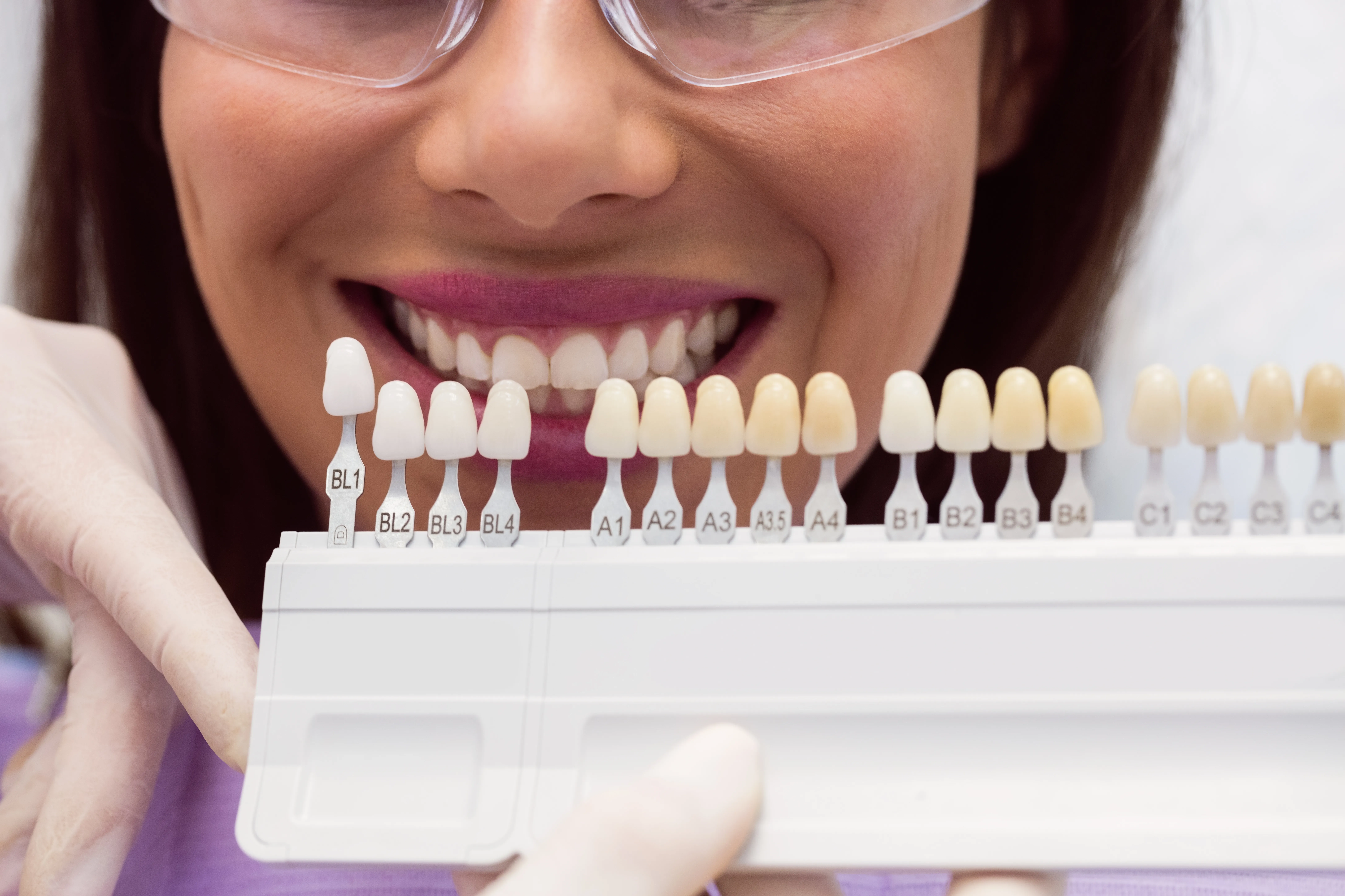 Hollywood white teeth shades