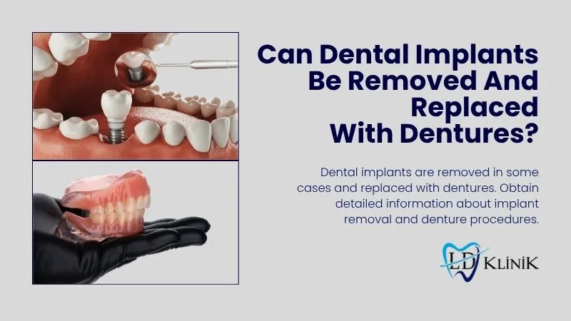 Dental implant removal and replaced with dentures