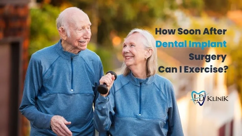 Exercise after dental implant